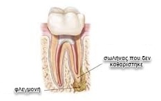 αρχείο λήψης (1)